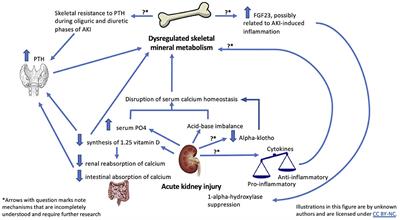 Acute Kidney Injury and Pediatric Bone Health